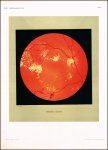 Oeller, Johann: Atlas der Ophthalmoskopie